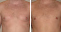 Before & After Photos
